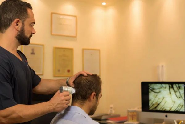Examination before the hair transplant using the FUE technique